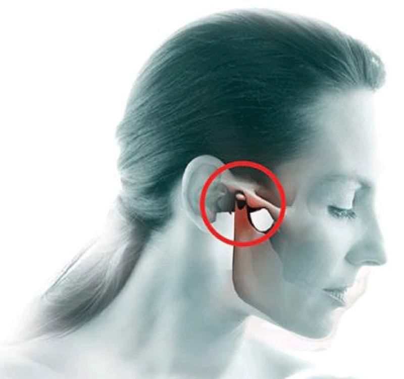 Tmd And Pregnancy Tmd And Pregnancy